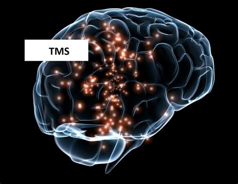 Contact TMS .